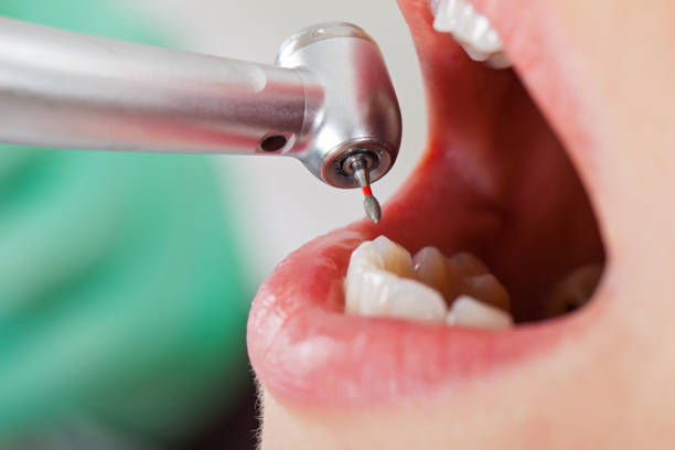 Best Emergency Dental Extractions in Rk Forest Village, PA